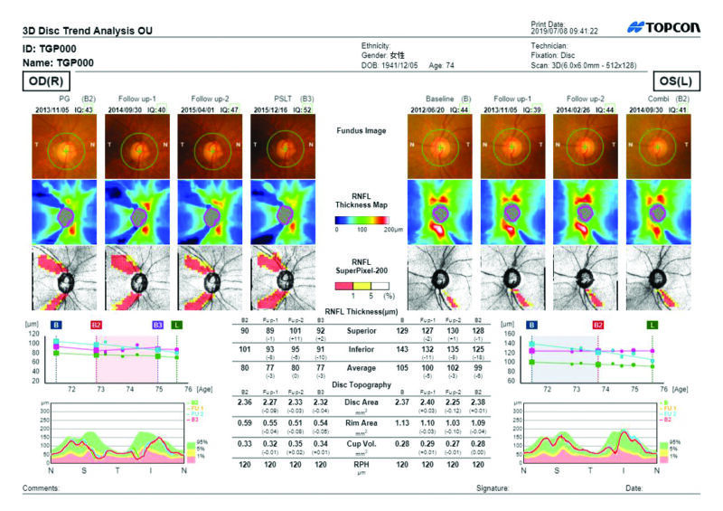 3D Disc OU Trend analysis