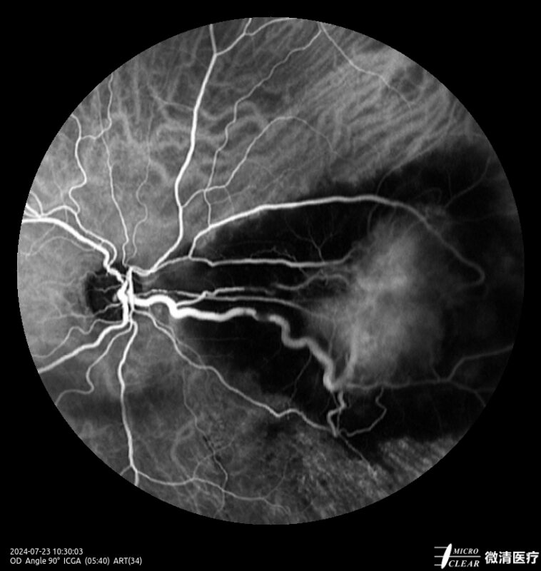 2024_07_23_10_27_14.098_ART(22)_ICGA- Carroussel 17