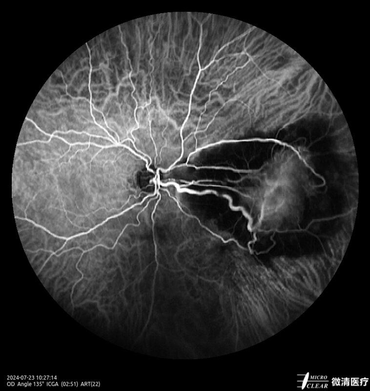 2024_07_23_10_27_14.098_ART(22)_ICGA-carrousel 15