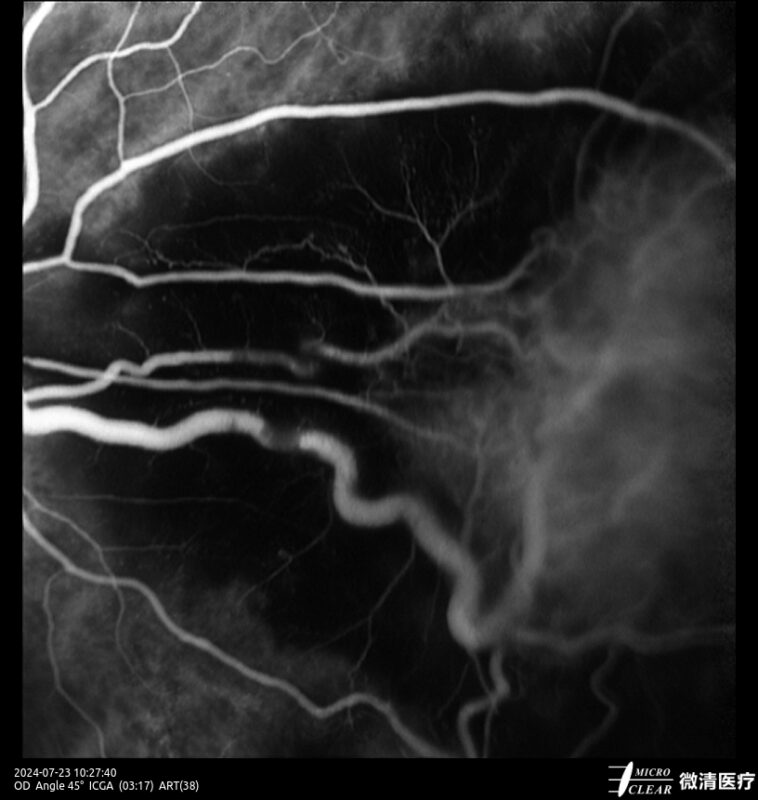 2024_07_23_10_27_40.905_ART(38)_ICGA- Carroussel 16