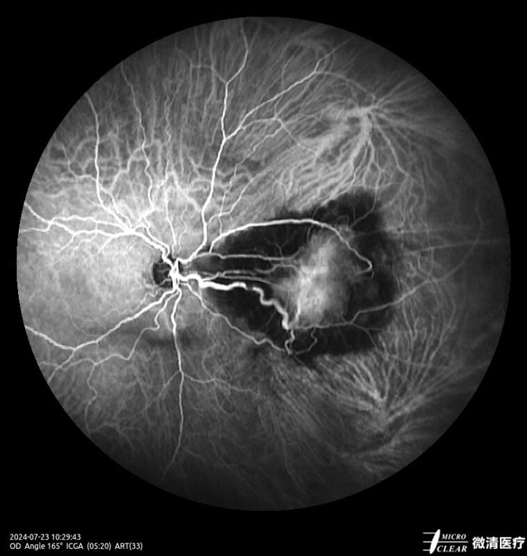 2024_07_23_10_29_43.258_ART(33)_ICGA- Carroussel 16