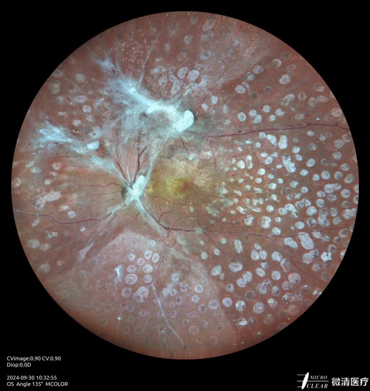 2024_09_30_10_32_55_752_MCOLOR- Carroussel 11