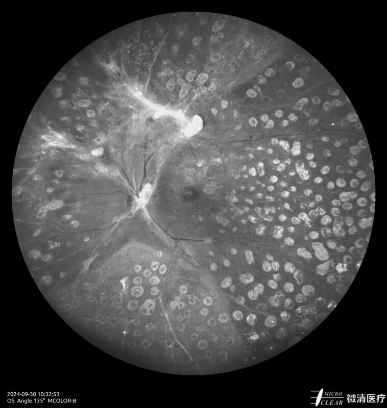 2024_09_30_10_32_55_752_MCOLOR_B- Carroussel 12