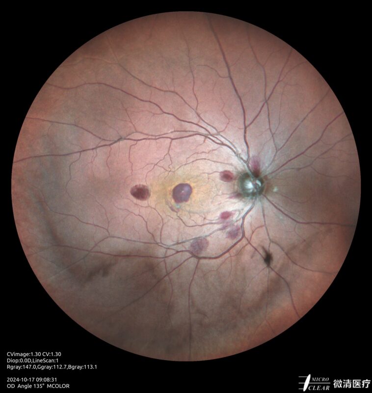 2024_10_17_09_08_31_397_MCOLOR- Carroussel 4