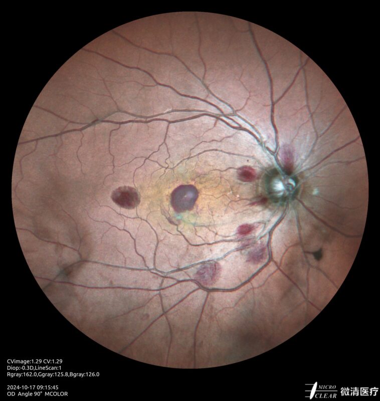 2024_10_17_09_15_45_228_MCOLOR- Carroussel 3