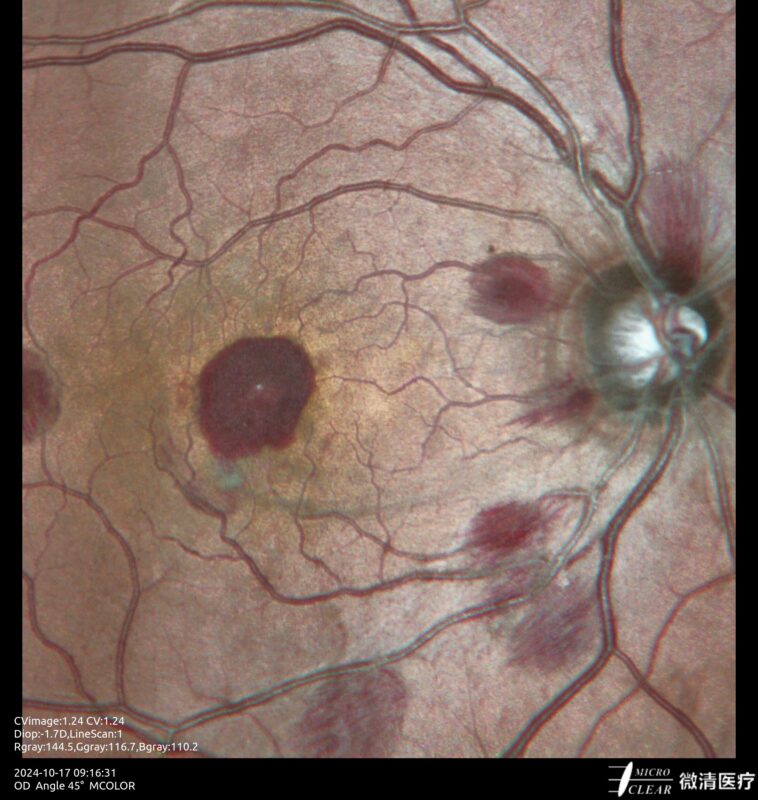 2024_10_17_09_16_31_635_MCOLOR- Carroussel 2