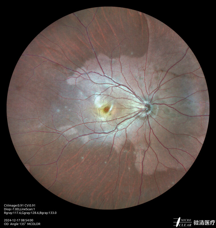 2024_12_17_08_54_00_861_MCOLOR- Carroussel 1