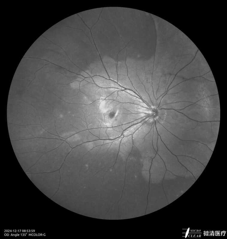 2024_12_17_08_54_00_861_MCOLOR_G- Carroussel 5