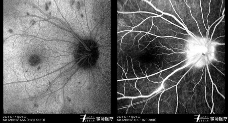 2024_12_17_10_29_50_348_ART(13-6)_ICGA-FFA Carroussel 9