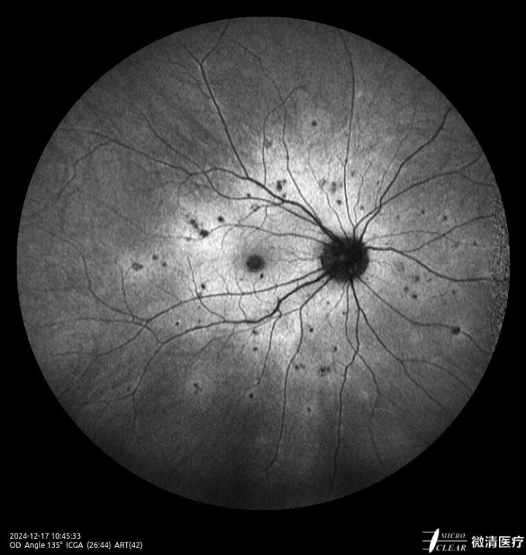 2024_12_17_10_45_33_024_ART(42)_ICGA Carroussel 18