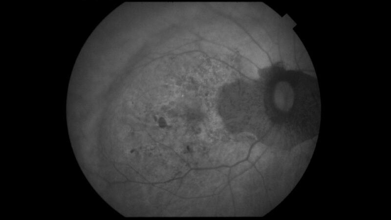 AMD 79 female_basler_OD