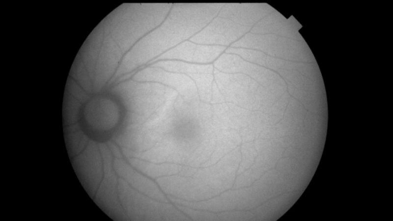 AMD 79 female_basler_OS